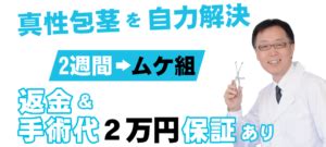 【自宅で試せる】おすすめの包茎矯正・改善グッズ6。